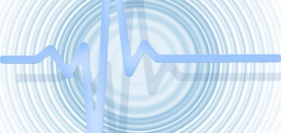 eine EKG Ansicht